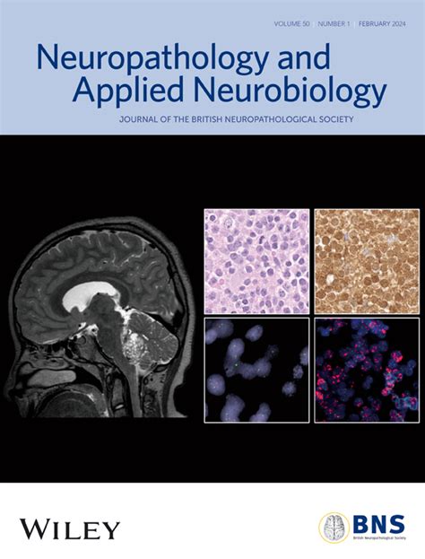 neuropathology near kelseyville  If most are not met they suggest longer-standing pathological process